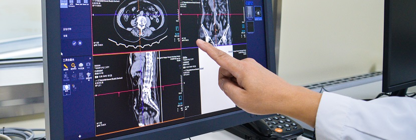 X射線計算機(jī)體層攝影(CT)裝置放射衛(wèi)生檢測評價
