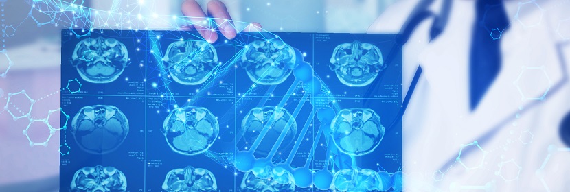 DSA(數字減影血管造影)放射衛(wèi)生檢測評價